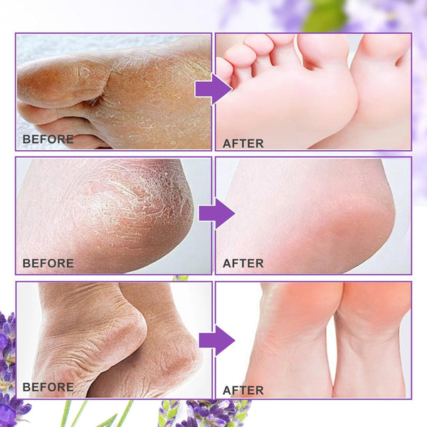 Măști Exfoliante pentru Picioare