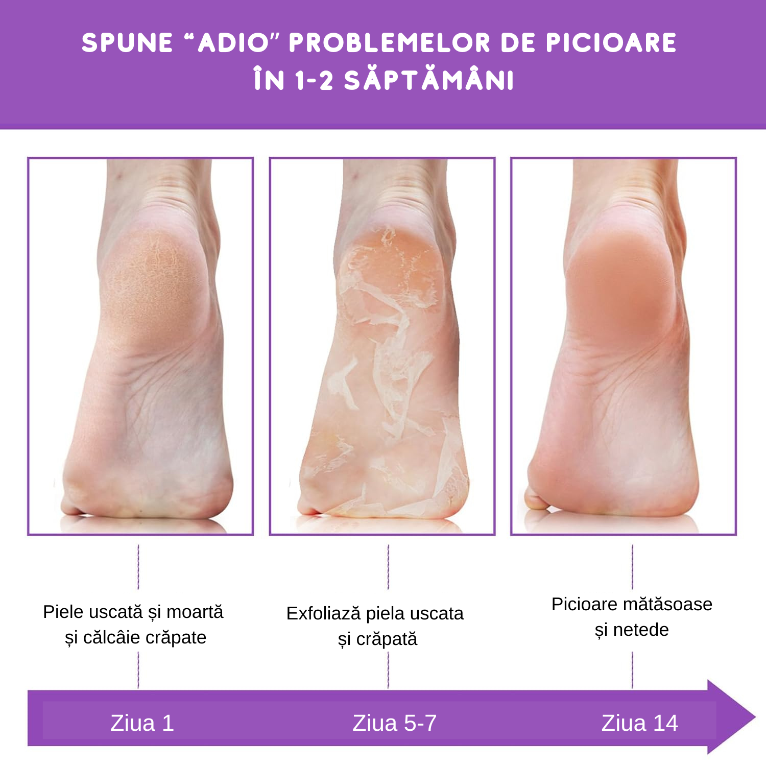 Măști Exfoliante pentru Picioare